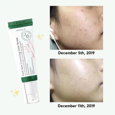 Лек и бързоабсорбиращ серум Axis-Y Dark Spot Correcting Glow Serum 50ml