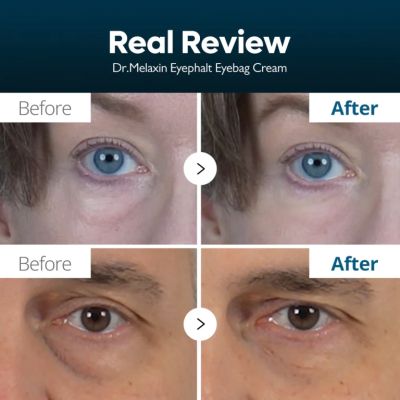 Околоочен крем против торбички под очите Dr.Melaxin Eyephalt Eyecream for Eyebags 10 ml